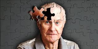 Alzheimer e Demência